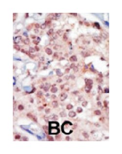 FRK, Rabbit, Polyclonal Antibody, Abnova 400&mu;L; Unlabeled:Antibodies,
