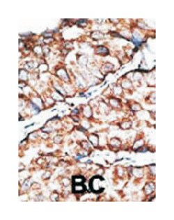 DKKL1, Rabbit, Polyclonal Antibody, Abnova 400&mu;L; Unlabeled:Antibodies,