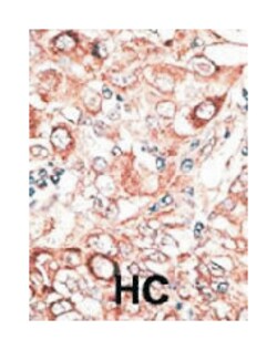 GJB2, Rabbit, Polyclonal Antibody, Abnova 400 &mu;L | Buy Online | Abnova Corporation | Fisher Scientific