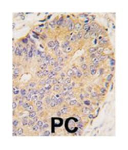 BMP15 Rabbit anti-Human, Polyclonal Antibody, Abnova 400 &mu;L | Buy Online | Abnova | Fisher Scientific