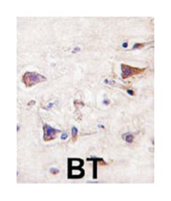PDGFA Rabbit anti-Human, Polyclonal Antibody, Abnova 400 &mu;L | Buy Online | Abnova Corporation | Fisher Scientific