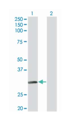 NAT2, Mouse, Clone: 3B5, Abnova 100&mu;g; Unlabeled:Antibodies, Monoclonal