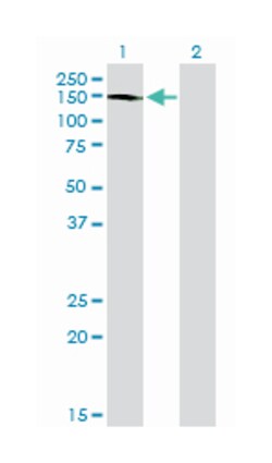ABL2, Mouse, Clone: 6D5, Abnova 100&mu;g; Unlabeled:Antibodies, Monoclonal