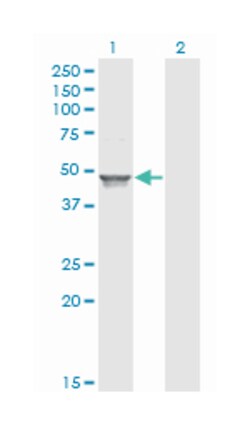 ACAA1, Mouse, Clone: 3F11, Abnova 100&mu;g; Unlabeled:Antibodies, Monoclonal