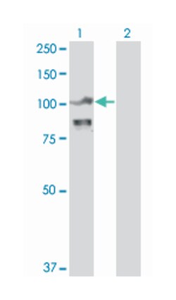 ACTN4 (M01), Mouse anti-Human, Mouse, Rat, Clone: 4D10, Abnova&trade;