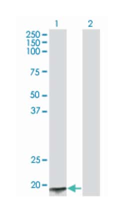 ACYP2, Mouse, Clone: 2H7, Abnova 100 &mu;g | Buy Online | Abnova Corporation | Fisher Scientific