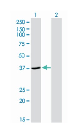 ADH4, Mouse, Clone: 3C5, Abnova 100&mu;g; Unlabeled:Antibodies, Monoclonal