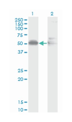 AHSG, Mouse, Clone: 1D8, Abnova 100&mu;g; Unlabeled:Antibodies, Monoclonal