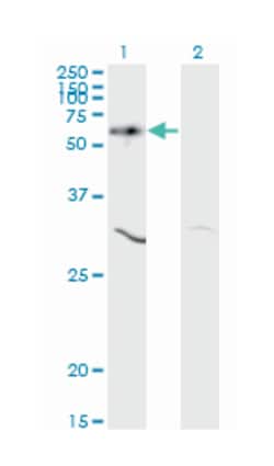 v-akt murine thymoma viral oncogene homolog 1, Mouse, Clone: 2E11, Abnova