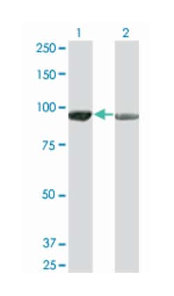 adenosine monophosphate deaminase 2 (isoform L), Mouse, Clone: 2F5, Abnova 50 &mu;g | Buy Online | Abnova Corporation | Fisher Scientific