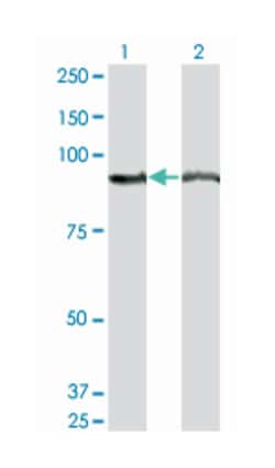 AMPD2 (M04A), Mouse anti-Human, Clone: 2G8, Abnova 200&mu;L; Unlabeled:Anticuerpos