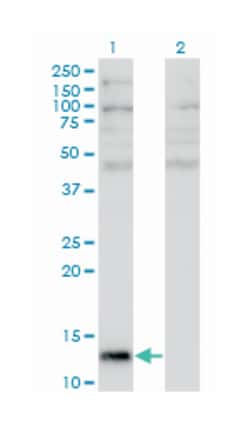 angiogenin, ribonuclease, RNase A family, 5, Mouse, Clone: 2A7, Abnova™