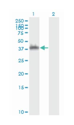 ANXA2, Mouse, Clone: 3E8-B6, Abnova 100&mu;g; Unlabeled:Antibodies, Monoclonal