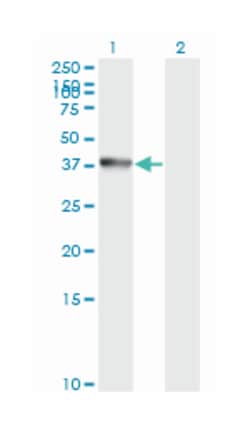 annexin A2, Mouse, Clone: 1G7, Abnova 100&mu;g; Unlabeled:Antibodies, Monoclonal