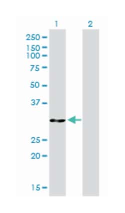 ANXA5, Mouse, Clone: 1F4-1A5, Abnova 100&mu;g; Unlabeled:Antibodies, Monoclonal