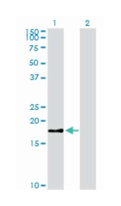 baculoviral IAP repeat-containing 5, Mouse, Clone: 5B10, Abnova 100&mu;g;