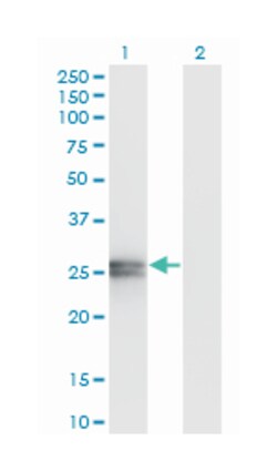 APOA1, Mouse, Clone: 3A11-1A9, Abnova 200&mu;L; Unlabeled:Antibodies, Monoclonal