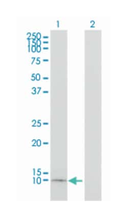 APOC1, Mouse, Clone: 2E2-1A3, Abnova 100&mu;g; Unlabeled:Antibodies, Monoclonal