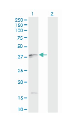 Fas ligand (TNF superfamily, member 6), Mouse, Clone: 2G9-G8, Abnova&trade;