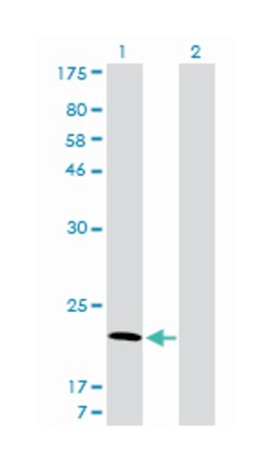 ADP-ribosylation factor 5, Mouse, Clone: 1B4, Abnova 100&mu;g; Unlabeled:Antibodies,