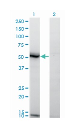 ASAH1, Mouse, Clone: 1A7, Abnova 100&mu;g; Unlabeled:Antibodies, Monoclonal