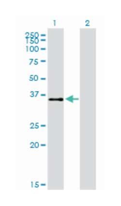 ATF1, Mouse, Clone: 3E7, Abnova 100 &mu;g | Buy Online | Abnova | Fisher Scientific