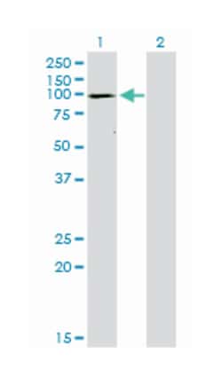 ATP2A1, Mouse, Clone: 1B11, Abnova™