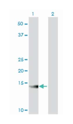 ATP6V1G2, Mouse, Clone: 2E11, Abnova 100&mu;g; Unlabeled:Antibodies, Monoclonal