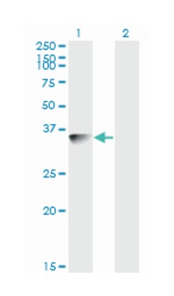 BLVRA, Mouse, Clone: S2, Abnova 100 &mu;g | Buy Online | Abnova | Fisher Scientific