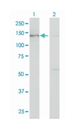 BUB1, Mouse, Clone: 2F9, Abnova 200&mu;L; Unlabeled:Antibodies, Monoclonal