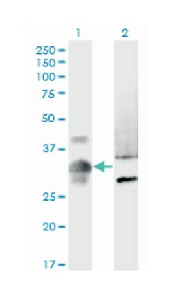 MPPED2, Mouse, Clone: 4H5, Abnova 100 &mu;g | Buy Online | Abnova Corporation | Fisher Scientific