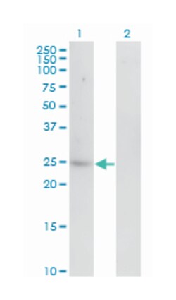 CA1, Mouse, Clone: 7G12, Abnova 100&mu;g; Unlabeled:Antibodies, Monoclonal