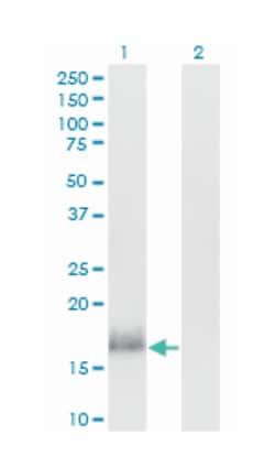 CALML3, Mouse, Clone: 2A11, Abnova 100&mu;g; Unlabeled:Antibodies, Monoclonal