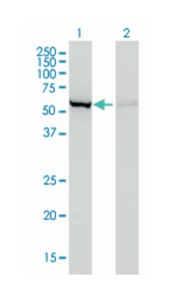 CBS, Mouse, Clone: 3E1, Abnova 100&mu;g; Unlabeled:Antibodies, Monoclonal