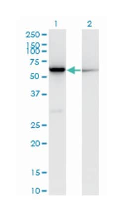 CBS, Mouse, Clone: 3D10, Abnova 100 &mu;g | Buy Online | Abnova Corporation | Fisher Scientific