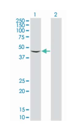 SCARB2, Mouse, Polyclonal Antibody, Abnova 50&mu;L; Unlabeled:Antibodies,