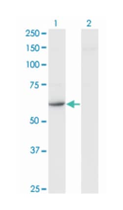 CDR2, Mouse, Clone: 4D2, Abnova 100&mu;g; Unlabeled:Anticuerpos