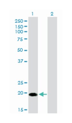CETN1, Mouse, Clone: 2A6, Abnova 100&mu;g; Unlabeled:Antibodies, Monoclonal