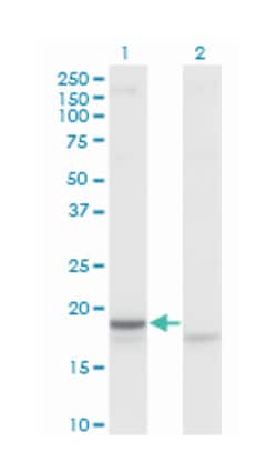 corticotropin releasing hormone, Mouse, Clone: 2B11, Abnova 100&mu;g; Unlabeled:Antibodies,