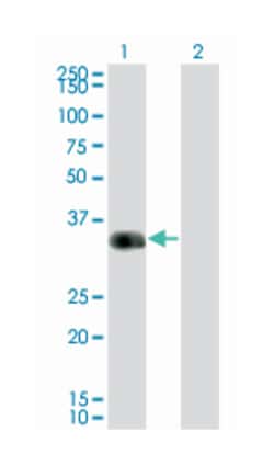 cone-rod homeobox, Mouse, Clone: F6-C2, Abnova 100&mu;g; Unlabeled:Antibodies,