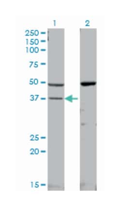 MAPK14, Mouse, Clone: 3D5, Abnova 200&mu;L; Unlabeled:Antibodies, Monoclonal