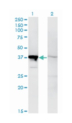 MAPK14, Mouse, Clone: 1C9, Abnova 100 &mu;g | Buy Online | Abnova Corporation | Fisher Scientific
