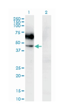 CSF2RA, Mouse, Clone: 2G5, Abnova 100&mu;g; Unlabeled:Antibodies, Monoclonal