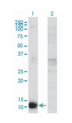 cystatin B (stefin B), Mouse, Clone: M2-F1, Abnova 100&mu;g; Unlabeled:Antibodies,