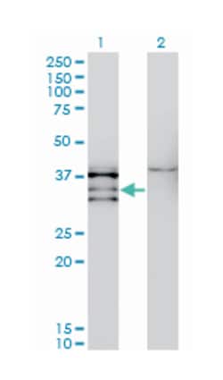 NKX2-5, Mouse, Clone: 3E3, Abnova 100&mu;g; Unlabeled:Antibodies, Monoclonal