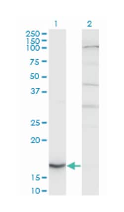CYB5A (M06), Mouse anti-Human, Clone: 1A8, Abnova 100&mu;g; Unlabeled:Antibodies,