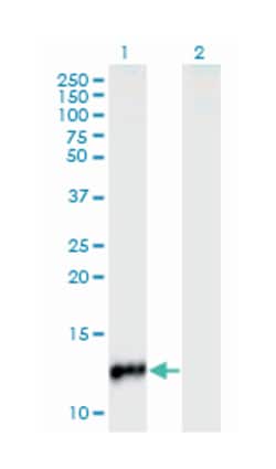 CYP24A1, Mouse, Clone: 1E1, Abnova 100&mu;g; Unlabeled:Antibodies, Monoclonal