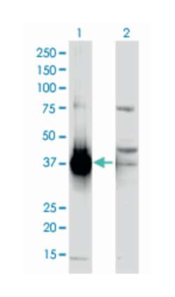 aldo-keto reductase family 1, member C2 (dihydrodiol dehydrogenase 2; bile