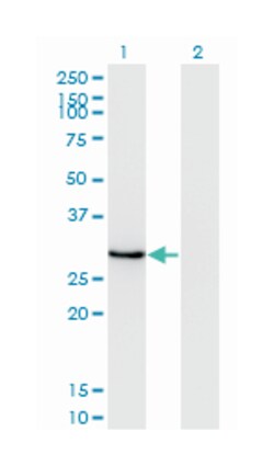 DLX1, Mouse, Clone: 4H7, Abnova 100&mu;g; Unlabeled:Antibodies, Monoclonal