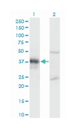 distal-less homeobox 3, Mouse, Clone: 3B8, Abnova 100 &mu;g | Buy Online | Abnova Corporation | Fisher Scientific